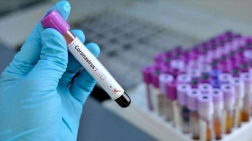 Novi sojevi covida se šire: Na ovih 12 simptoma trebate obratiti pažnju